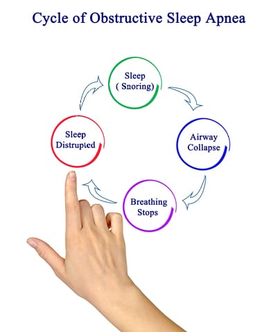Cycle Of Obstructive Sleep Apnea